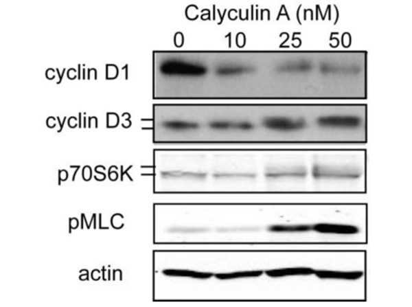 Western Blot using pMLC
